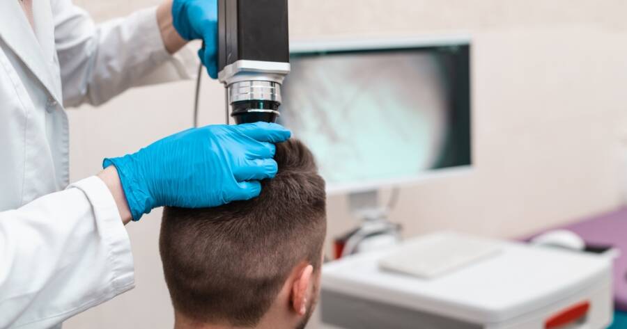 Understanding Hair Transplant Options and Techniques